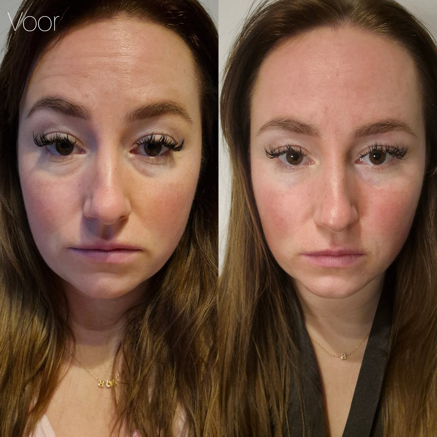 Chelly's Beauty Salon - Cuppings set + olie