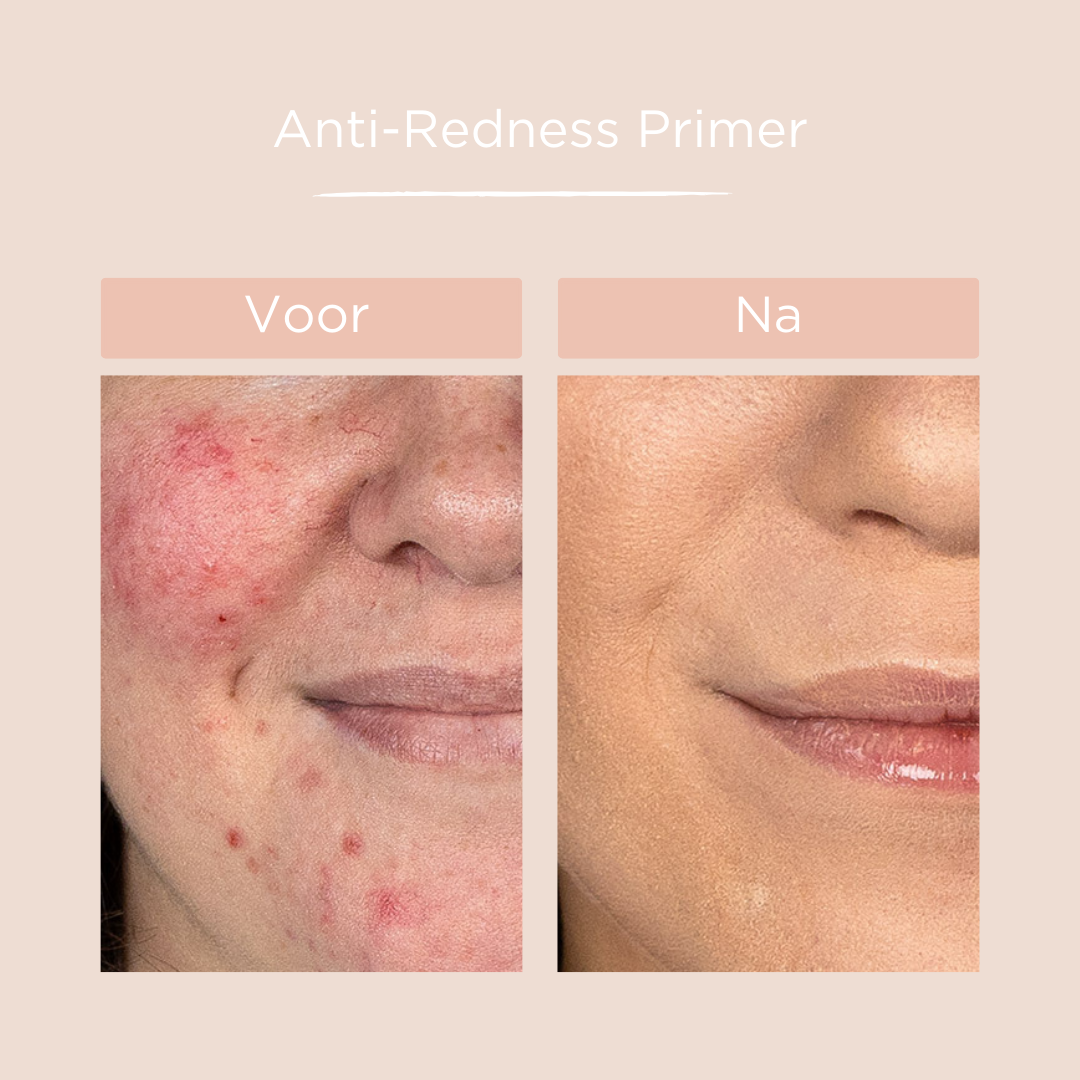 Cent Pur Cent - Anti-Redness Primer